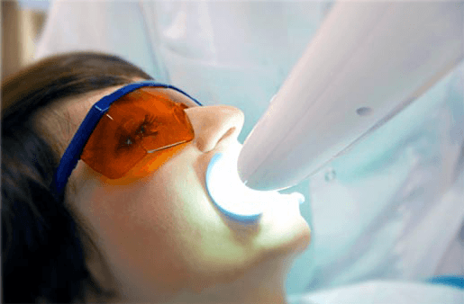 Understanding the Causes of Teeth Sensitivity Gosport