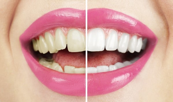 What Early Signs of Oral Cancer Should You Never Ignore Gosport?