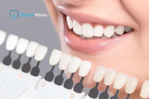 How to Maximise the Results of Your Laser Teeth Whitening Treatment Gosport