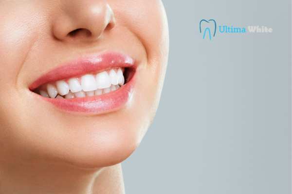 Common Mistakes That Can Ruin Your Whitening Results Gosport