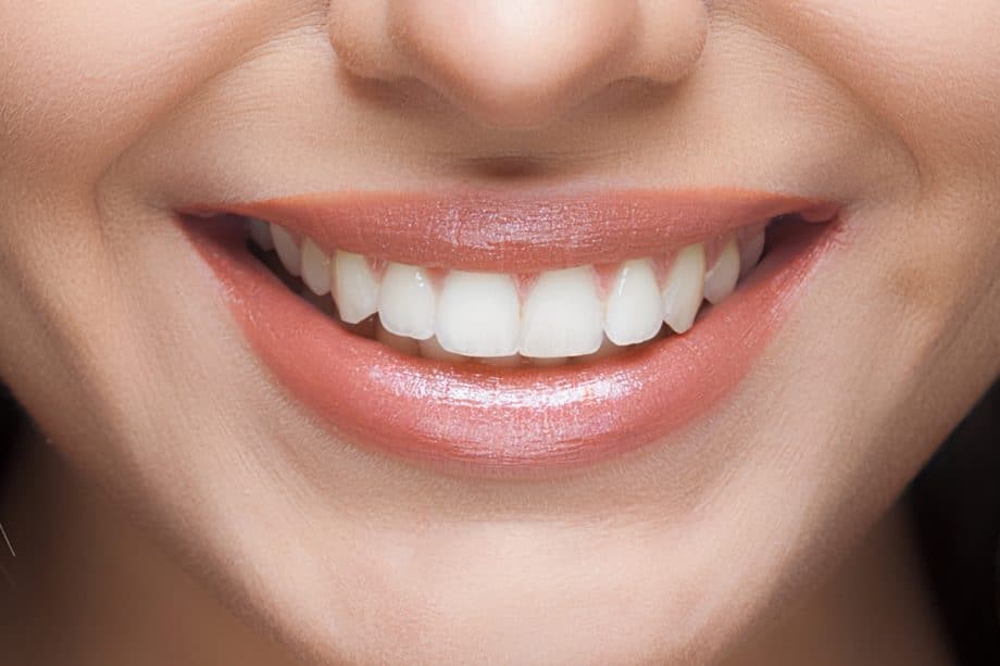 The Impact of White Spots on Oral Health Gosport