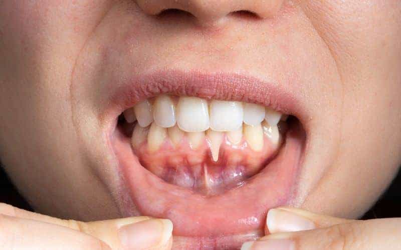 Final Thoughts: Building Lifelong Enamel Protection Habits Gosport