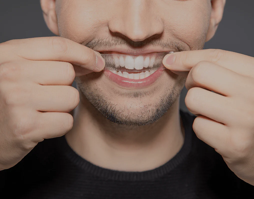 Can You Whiten Natural Teeth Without Harsh Chemicals Gosport?