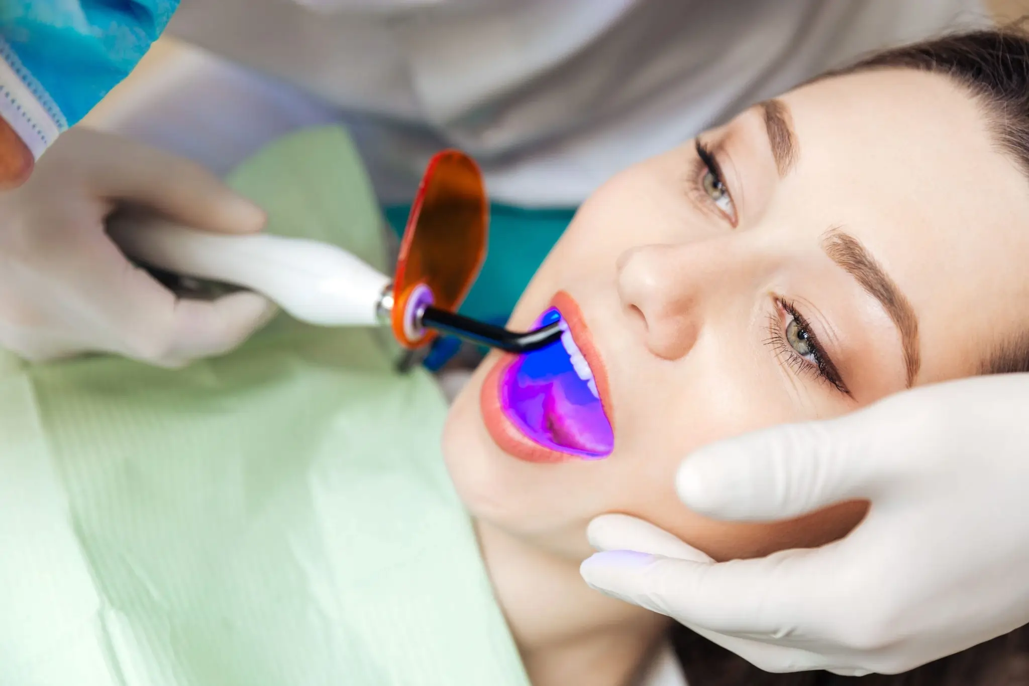 Common Risks of Whitening Without Expert Dental Guidance Gosport