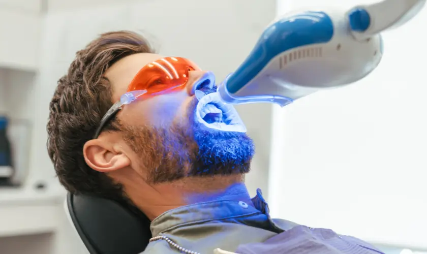 When Should You Consider Professional Whitening Instead Gosport?