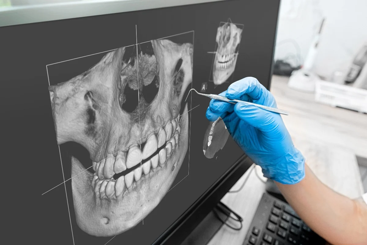 How Is AI Transforming Dental Treatment Planning Gosport?