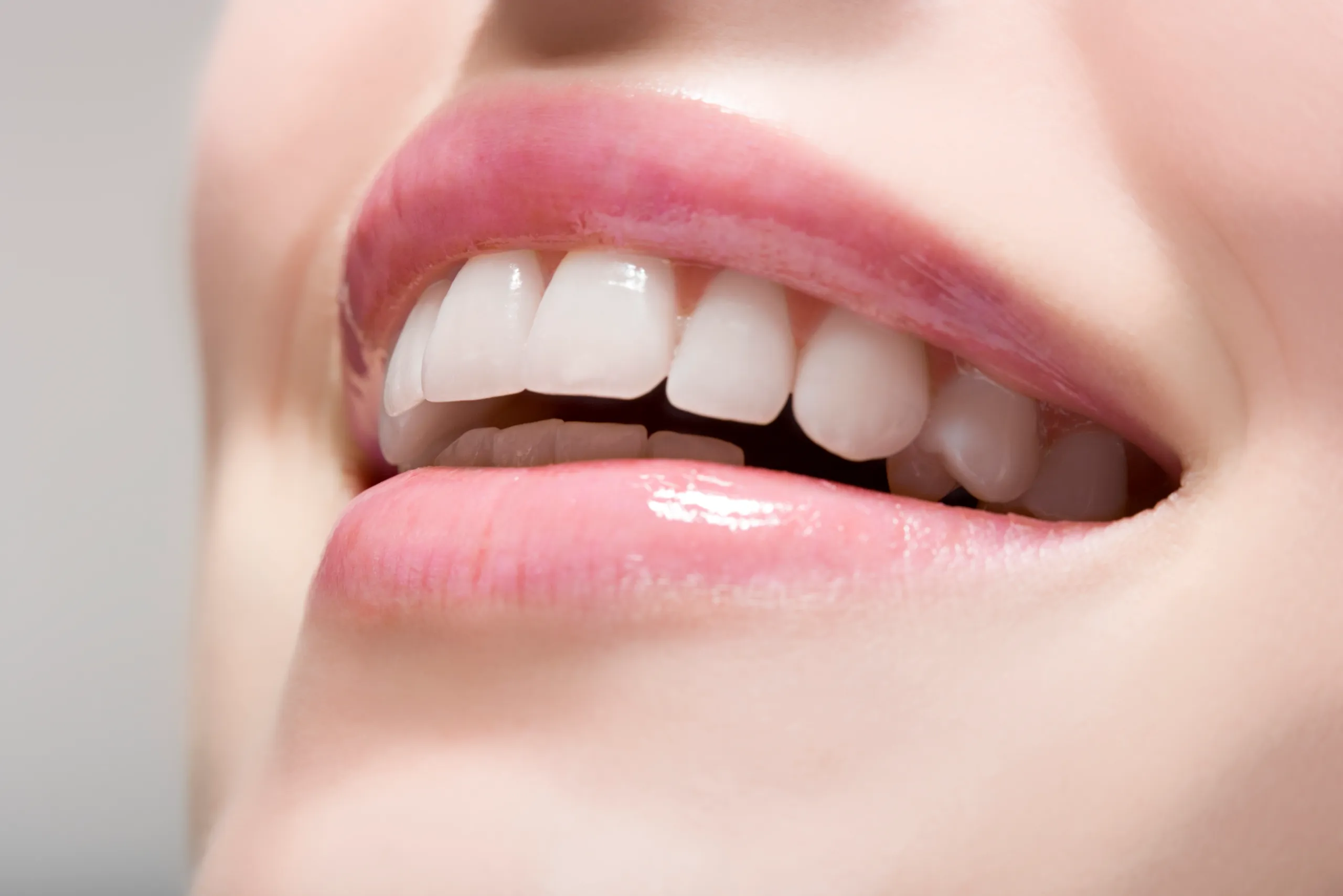 Myths and Misconceptions About White Spots Gosport