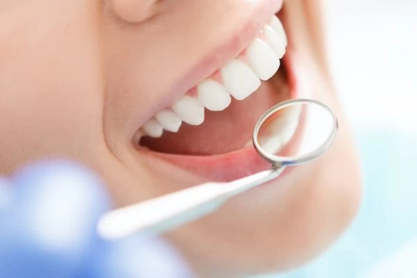 Preventing White Spots on Teeth Gosport