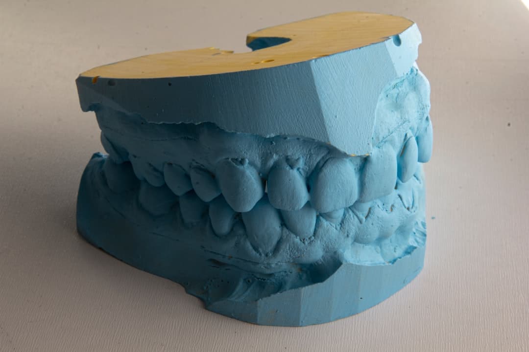 How Do Dental Implants Improve Jawbone Health and Oral Function Gosport?