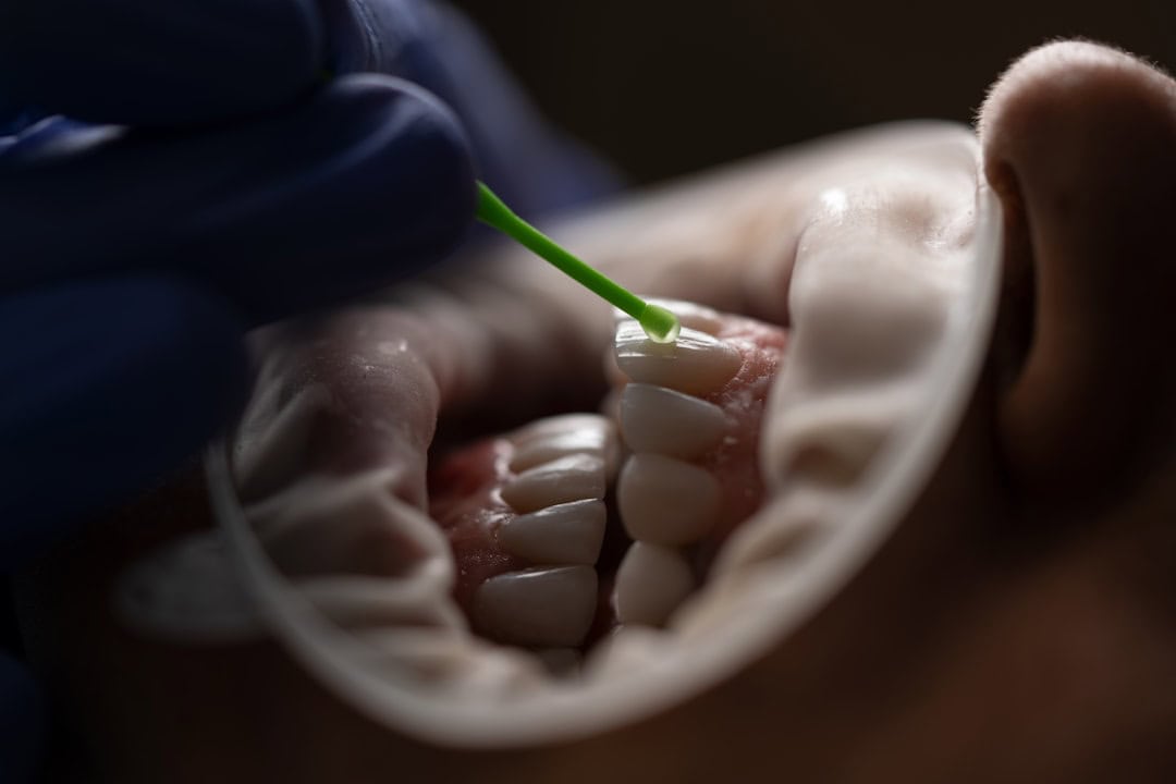 How Saliva Protects Your Teeth and Gums Gosport