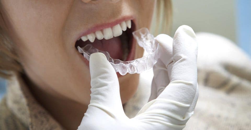 Can Bruxism Affect Your Sleep Quality Gosport