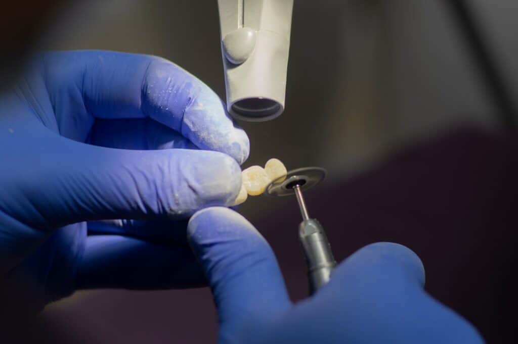 Customised Dental Solutions: Crowns, Aligners, and Implants Gosport