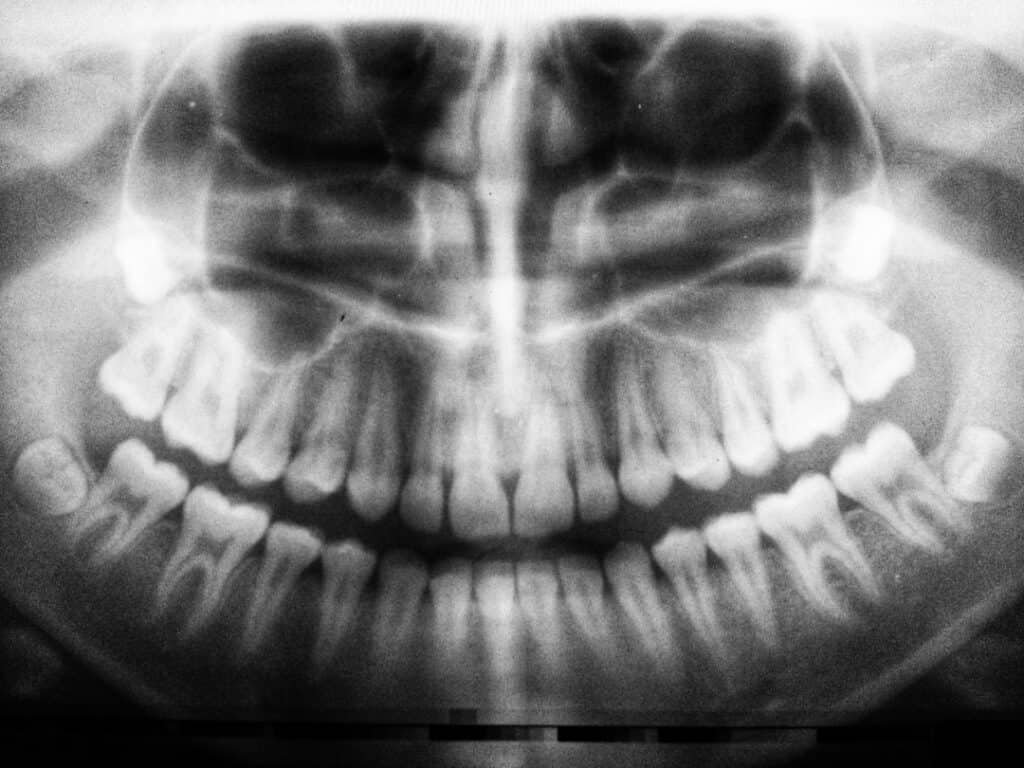 The Future of 3D Printing in Oral Healthcare Gosport