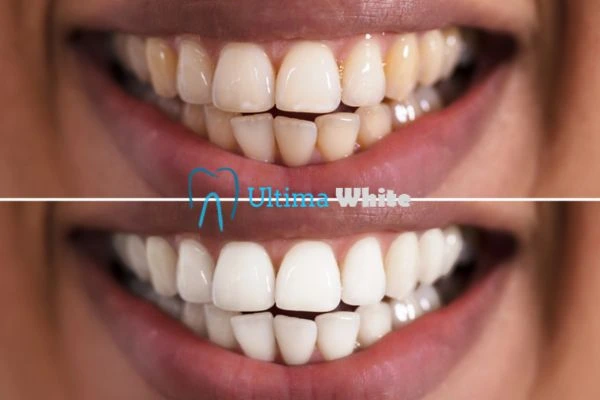 Long lasting results from Ultima White Gosport